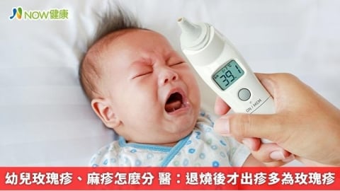 幼兒玫瑰疹、麻疹怎麼分 醫：退燒後才出疹多為玫瑰疹