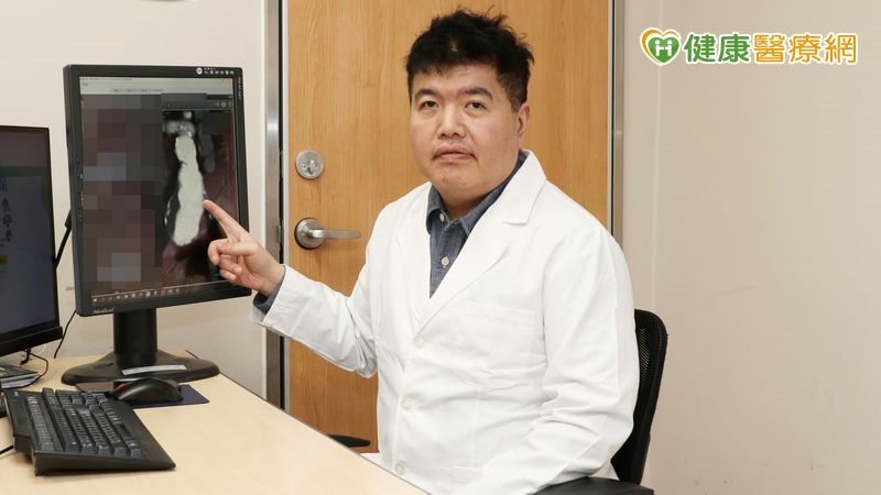 肚裡的隱形炸彈！九旬長者突發劇烈腹痛 　「腹主動脈瘤」險釀致命危機