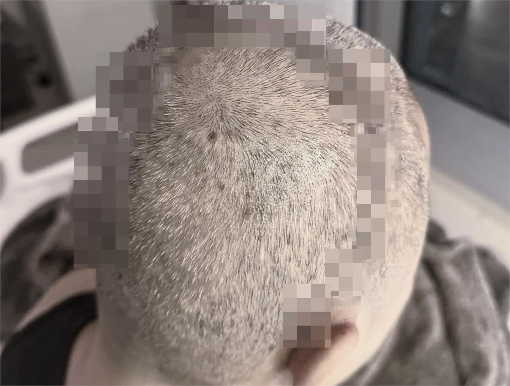 草蜢開唱全場淚崩！蔡一傑首談腦癌手術「暴瘦9公斤」1年後現況曝光