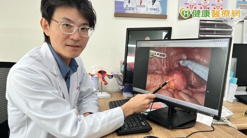 巧克力囊腫復發導致腎水腫　醫療團隊聯手成功保腎