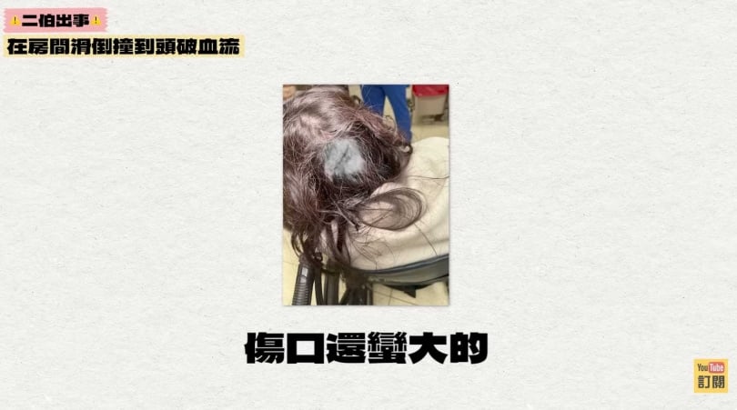 二伯在家裡跌倒，頭縫了9針。（圖／翻攝YouTube／蔡阿嘎Life）