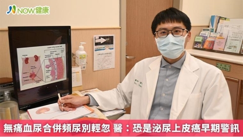 無痛血尿合併頻尿別輕忽 醫：恐是泌尿上皮癌早期警訊