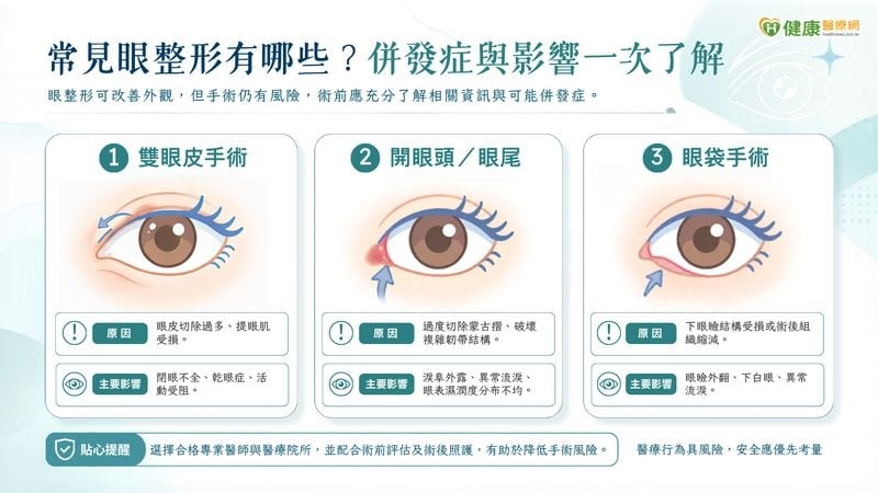 眼整形術後乾眼、閉眼困難？醫說明多元重建對策　眼部結構修復是關鍵