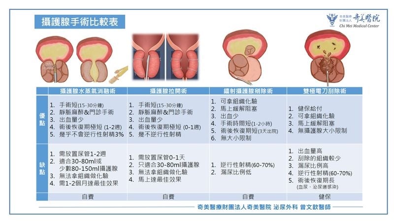 頻尿影響出遊興致　升級版水蒸氣消融術解排尿壓力