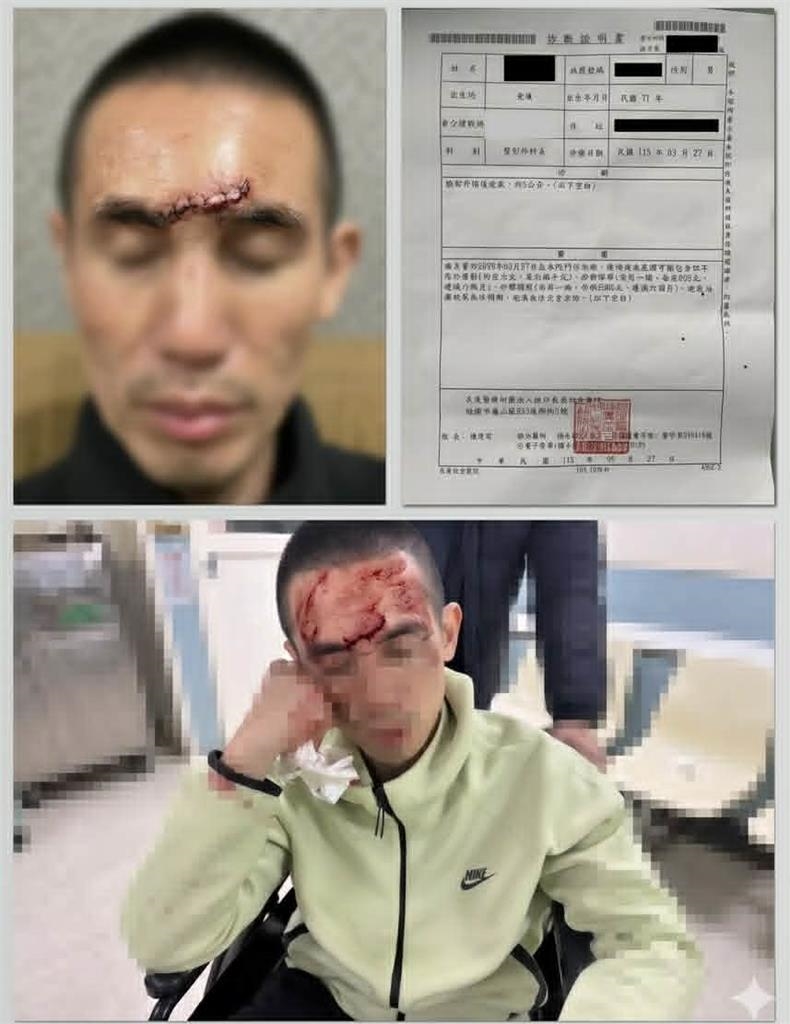 獨家/玩滑車額頭撞地縫10針 男恐終身留疤控園方已讀不回