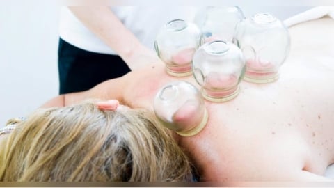 艾草溫罐屬醫療行為！　衛福部：非醫事人員施作「最高重罰150萬」