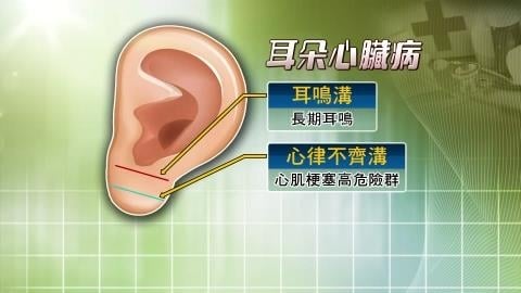 「耳垂猛縮、下顎痛」別輕忽救命警訊！醫揭「心肌恐壞死」非典型症狀：誤判痛覺