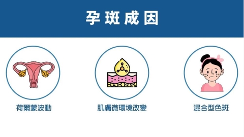 產後臉上長斑消不掉？解析「孕斑」成因與安全保養觀念