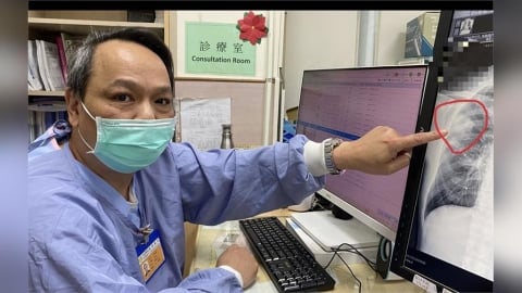 壯男日本旅遊「咳二天就送急診」   醫一見已肺膿瘍合併肺炎