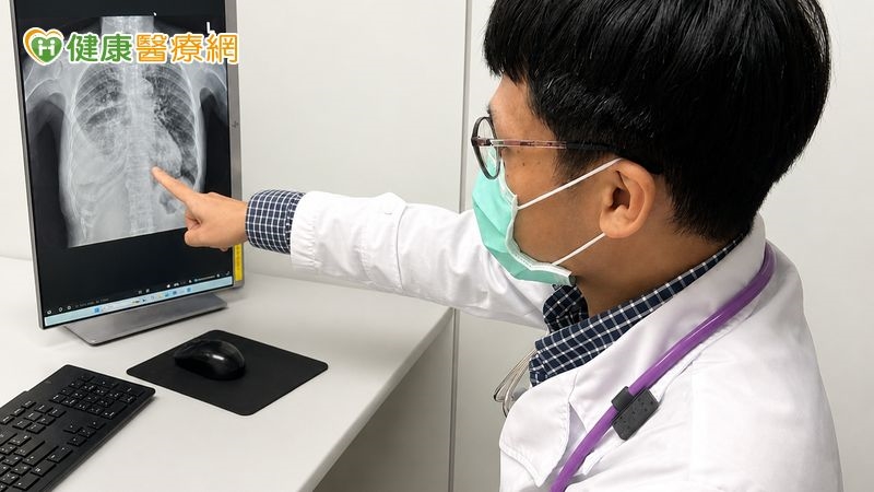 40歲女旅遊染「黴漿菌肺炎」　醫：咳嗽逾1週應盡快就醫！
