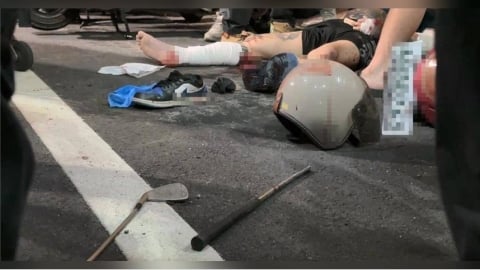 嗆聲惹禍！台東男凌晨家門口慘遭4人狂砍　全身5處刀傷送醫搶救