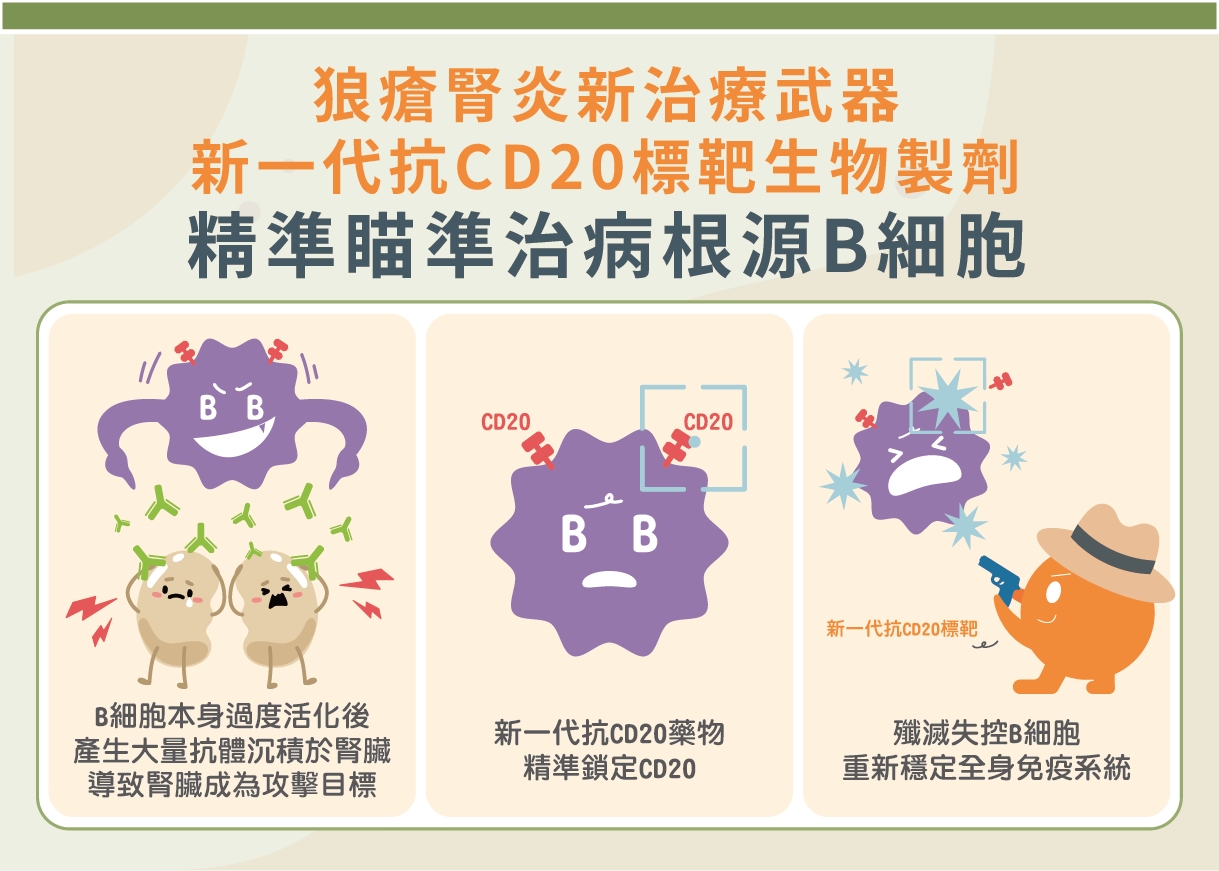 紅斑性狼瘡每2人就1人併發腎炎！新抗CD20標靶生物製劑助類固醇減量