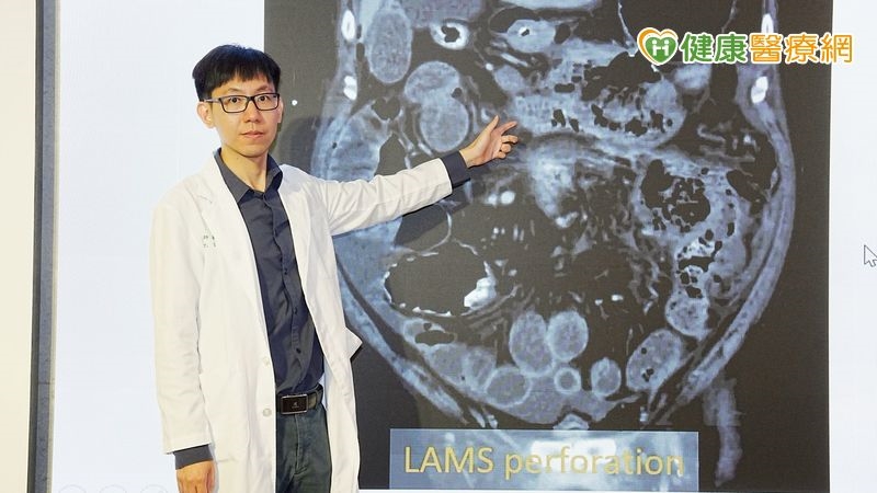 腹痛誤當胃脹氣！39歲男確診壞死性胰臟炎　醫警告：死亡率高達6成