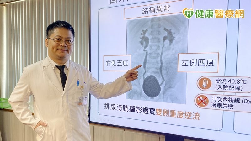 孩子反覆高燒、痙攣別只當感冒!醫警告:恐是「尿液倒流」傷腎