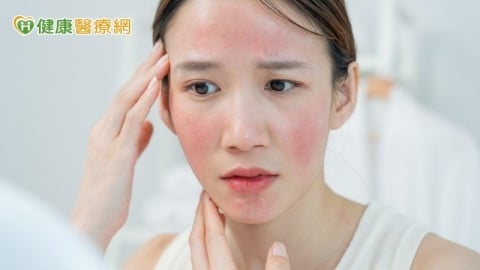 妝容不服貼還伴隨刺癢灼熱　當心是酒糟膚質在作祟