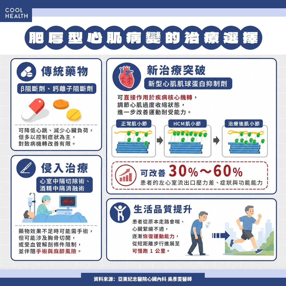 心肌肌球蛋白抑制劑上線 治療邁入精準時代