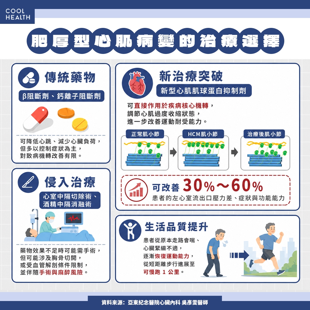 心肌肌球蛋白抑制劑上線 治療邁入精準時代