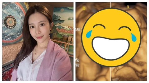鄭家純懷胎16週爆身材「1變化」!曬超音波「雙寶做1姿勢」:在安慰我