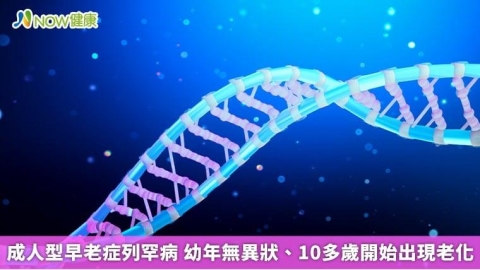 成人型早老症列罕病 幼年無異狀、10多歲開始出現老化