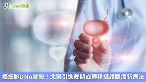 癌細胞DNA擊殺!北榮引進晚期或轉移攝護腺癌新療法
