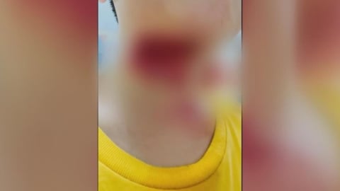 雲林北港水道頭園區鋼索險要命！　孩童遭勾脖重摔腦震盪