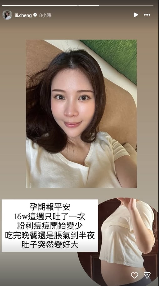 鄭家純「中空裝」挺4月雙胞胎孕肚現身!不科身形曝光 認1處:變超大