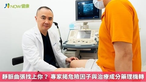 靜脈曲張找上你? 專家揭危險因子與治療成分藥理機轉