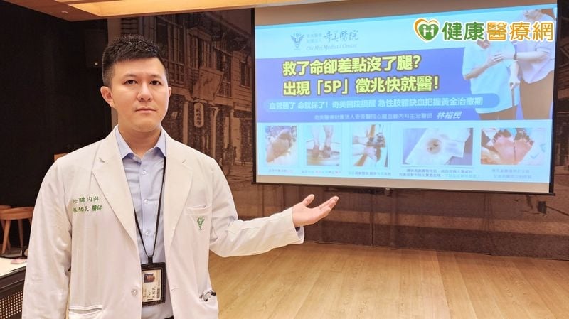 雙腳發黑恐非循環不良!她「急性肢體缺血」即時搶救保住腿