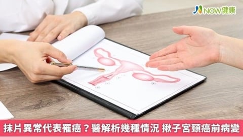 抹片異常代表罹癌?醫解析幾種情況 揪子宮頸癌前病變