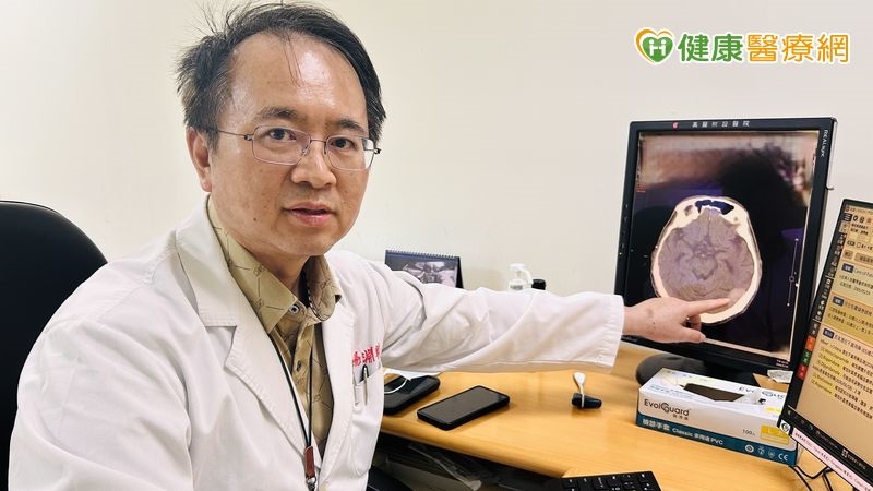 失智症不是突然發生!醫:病變可能提早數十年開始 揭判斷關鍵