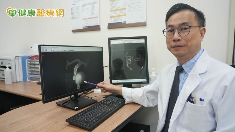 別誤當成老花眼!65歲婦人突見「雙影」竟揪出兩顆大型腦動脈瘤