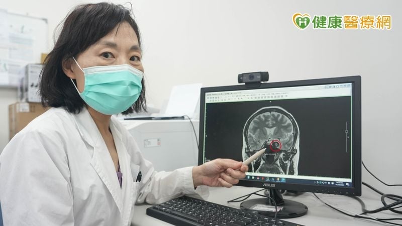 別誤當成老花眼!65歲婦人突見「雙影」竟揪出兩顆大型腦動脈瘤