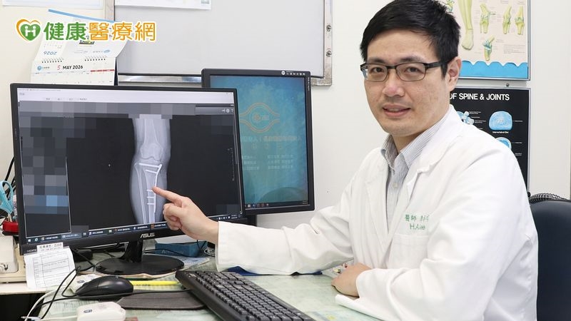 樓梯踩空膝蓋骨折 高壓氧輔助消腫防範軟組織壞死
