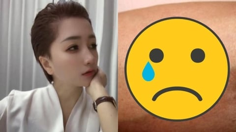 39歲網紅遭蟲咬病逝!疾管署急警「死亡率飆60%」台灣已56例確診