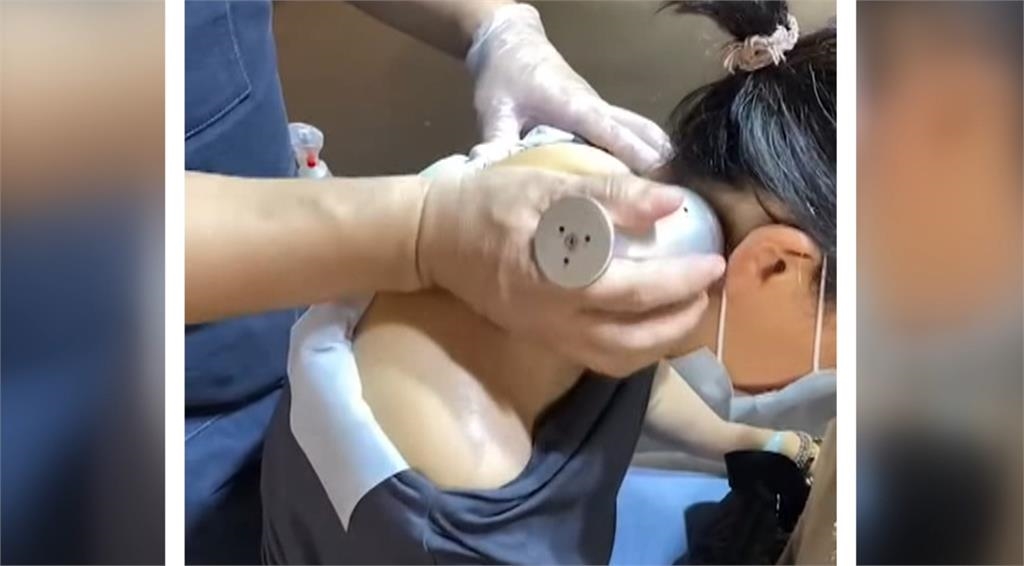異言堂／ 艾草溫罐是中醫師業務？　台北市幾乎無診所提供