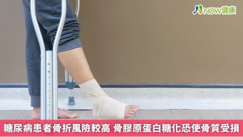 糖尿病患者骨折風險較高 骨膠原蛋白糖化恐使骨質受損