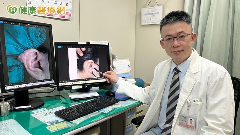 穿耳洞長出「精靈耳」！女大生蟹足腫釀耳廓變形　手術重建找回耳型
