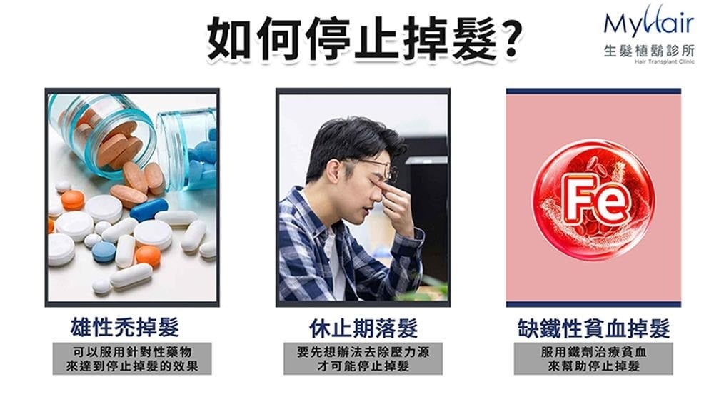 頭髮越長掉越多？醫師解析掉髮原因與日常照護重點