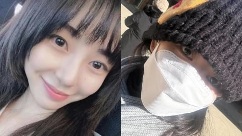 韓國女星「二度灼傷」遭毀容！曬「大片紅疤」連發3篇文淚訴經過