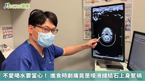 不愛喝水要當心！ 進食時劇痛竟是唾液線結石上身惹禍