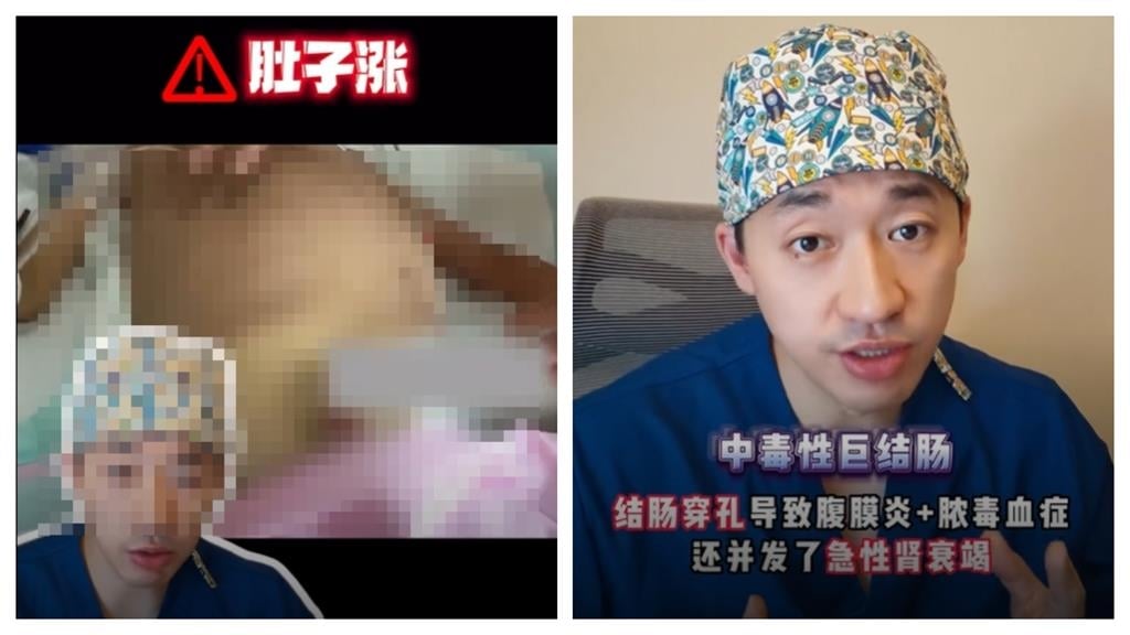 結腸穿孔險喪命!9歲童吃夜市「1食物」緊急進ICU 醫曝關鍵原因