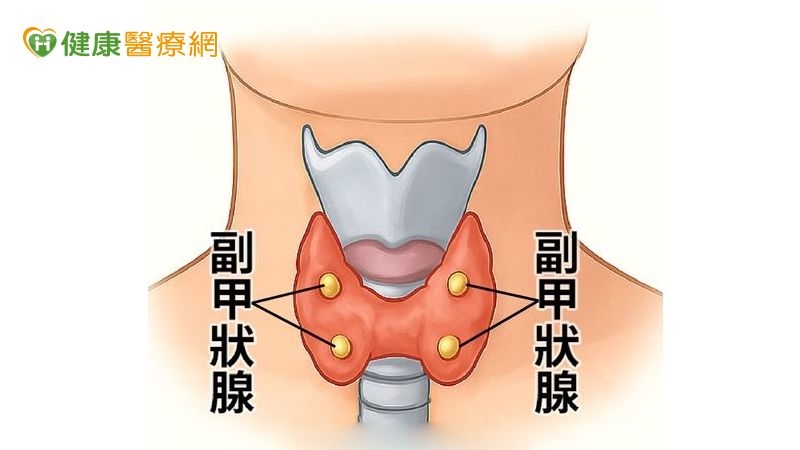 結石打完又長 竟是「脖子」惹禍?醫:恐是副甲狀腺瘤警訊