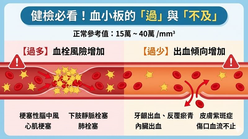 血小板飆破60萬　男子腦中風才知罹血液病