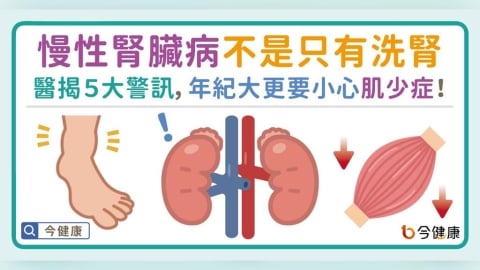 慢性腎臟病不是只有洗腎!醫揭「泡水高貧倦」5警訊:年紀大更要小心肌少症