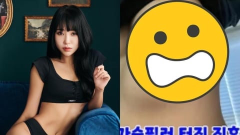 女星砸千萬隆乳慘變惡夢!填充物下垂到肋骨變「4個胸部」畫面首度公開