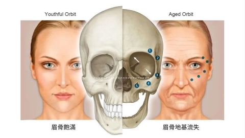 面對老化別只看皺紋：分齡肌膚管理成新趨勢