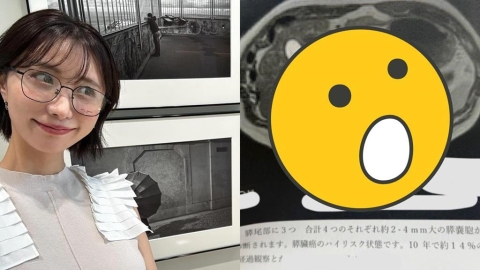 前女團成員「胰臟查出4顆腫瘤」崩潰!自曝「兩年前健檢全A」認1事:太放縱