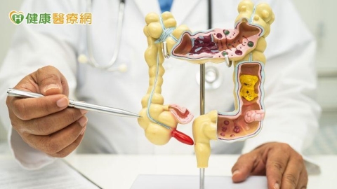 腸癌「TNT治療」保留肛門!適用癌友多