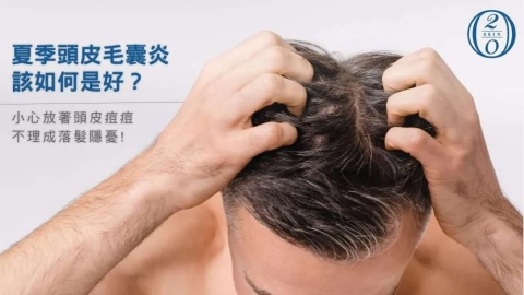 夏天頭皮痘痘反覆發作怎麼辦?認識頭皮毛囊炎與頭皮健康管理重點