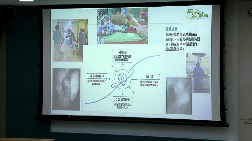 非洲7歲"無肛症女童"跨半個地球 北醫附醫助重獲新生